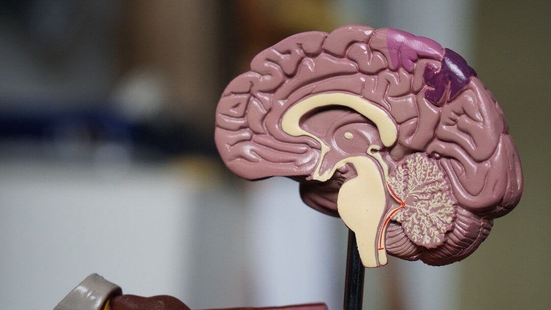 Anatomical model of a human brain