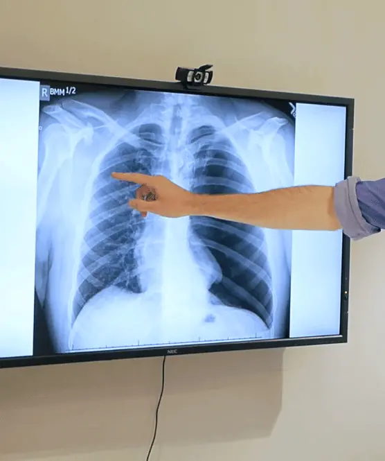 tutor pointing to a screen showing an x-ray of a chest and lungs