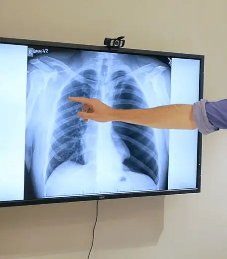 Online-medicine-course-for-teenagers (1) OxBright Medicine student pointing at a chest x-ray