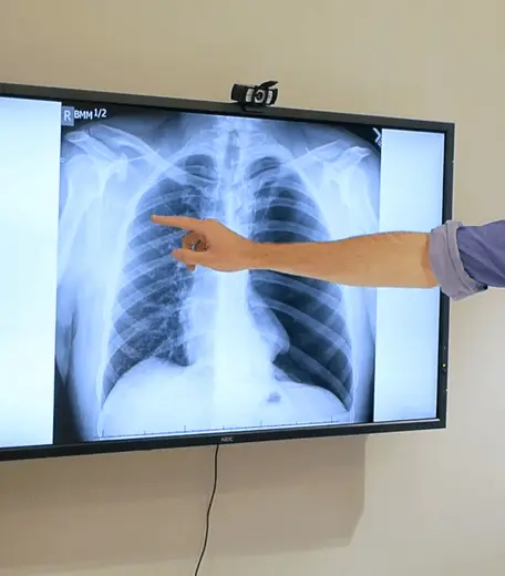 OxBright Medicine tutor pointing to a screen showing an x-ray of a chest and lungs